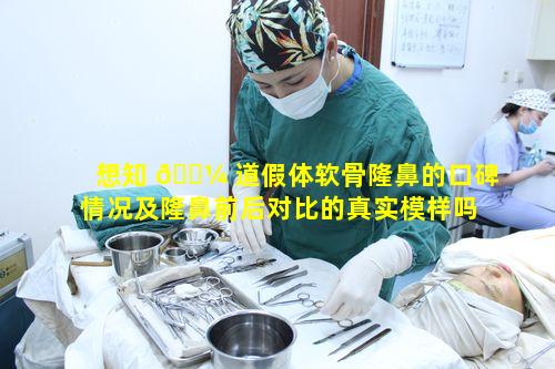 想知 🌼 道假体软骨隆鼻的口碑情况及隆鼻前后对比的真实模样吗 🦟